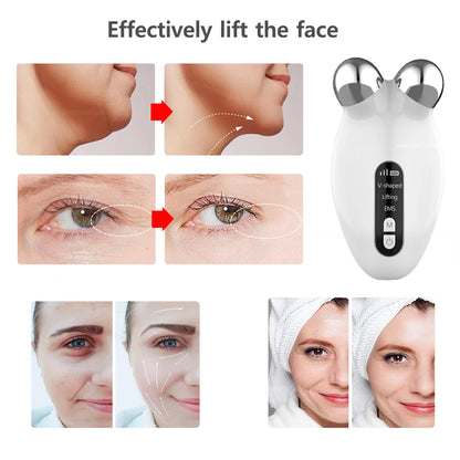 Masajeador Facial EMS: Dispositivo de Microcorriente para Lifting Facial